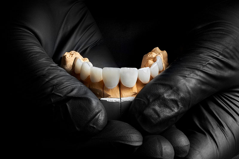 Exploring Tooth Covering Options: How Porcelain Veneers Enhance Your Smile