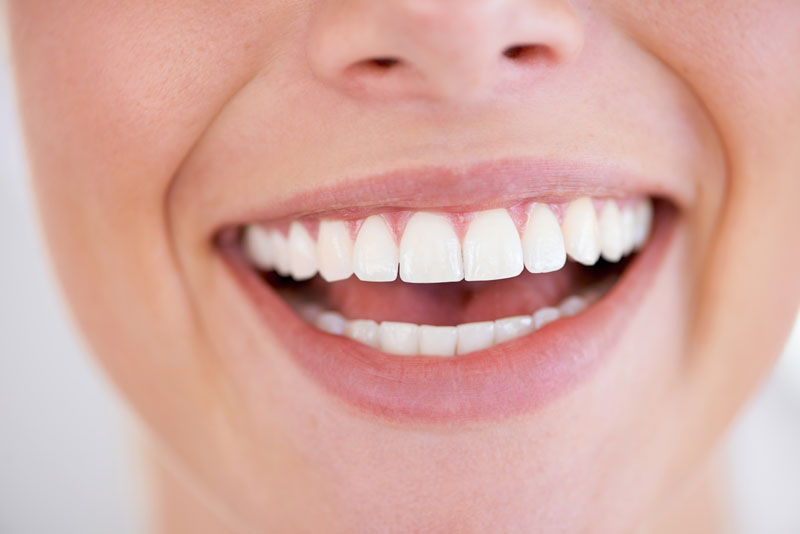 Discover the Top Advantages of Porcelain Veneers for Achieving a Perfect Smile