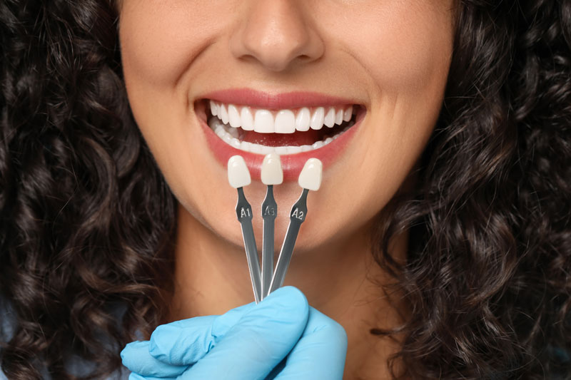 a woman getting color matched veneers